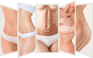How does Ultrasound Cavitation Body Slimming Treatment Remove Stubborn Fat?